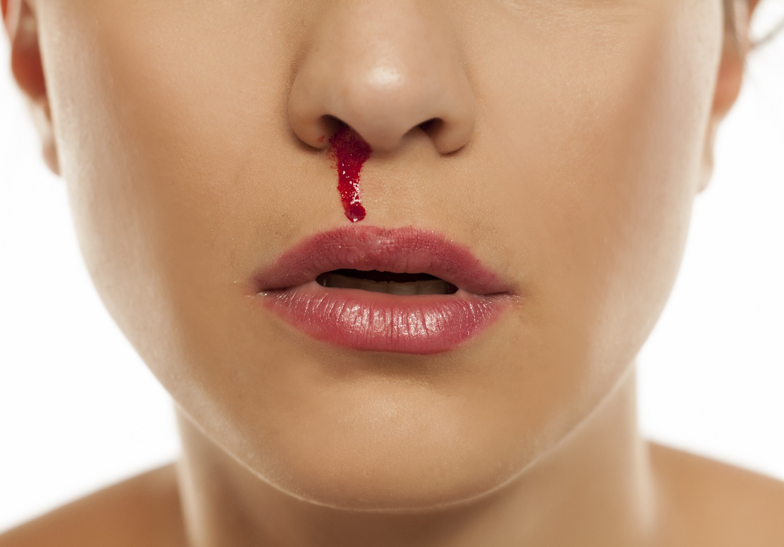 Krvácanie z nosa: Toto sú tipy a rady, ako ho zastaviť!