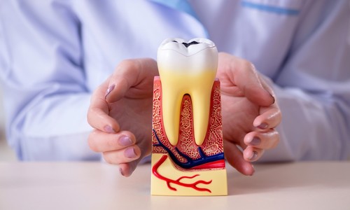 Čo poškodzuje zuby? Pozor na nevhodné návyky i niektoré potraviny!