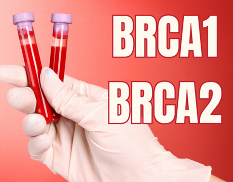 BRCA mutácie – kto je ich nositeľom a riziko ktorých druhov rakoviny zvyšujú?