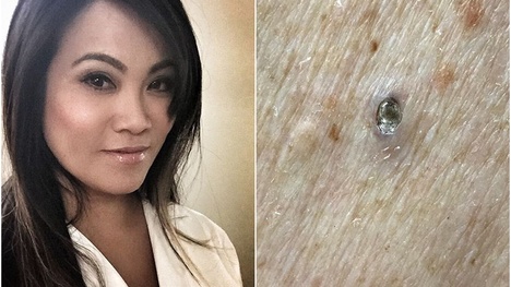 Dermatologička Sandra Lee: Videá, kde vytláča akné sledujú milióny ľudí