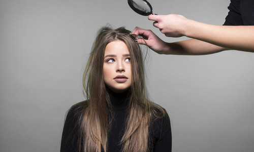 TOP 5 problémov s vlasmi, ktoré nenávidíme: Máš ich aj ty?