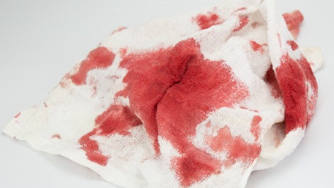 Ako odstrániť krv z oblečenia? Tieto triky ju zlikvidujú v okamihu!