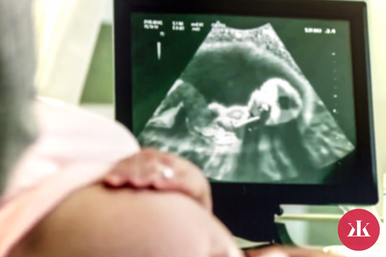 ultrazvuk - pohlavie dieťaťa