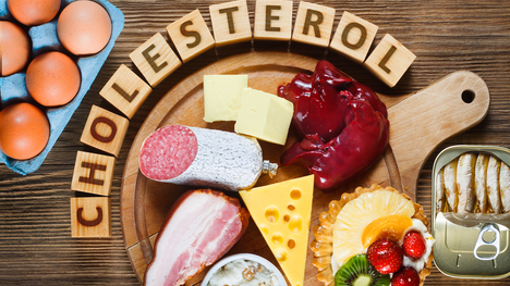Čo sú fakty a čo nie? Toto sú najväčšie mýty o cholesterole!