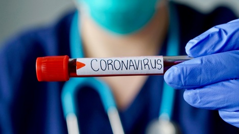 AKTUÁLNE: Koronavírus na Slovensku: Prvý potvrdený prípad v Bratislave!