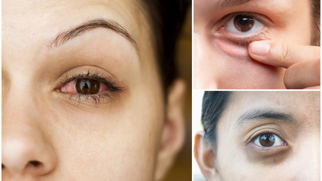Problémy s očami: Čo znamenajú suché oči alebo zažltnuté bielka?