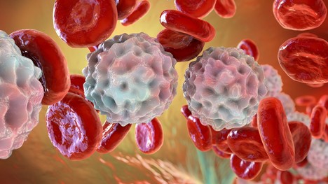 Leukocytóza alebo zvýšený počet bielych krviniek – aké sú príčiny?