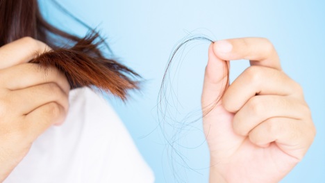 Vieš, ako poraziť vypadávanie vlasov? Pomôže ti tento tradičný a overený recept!