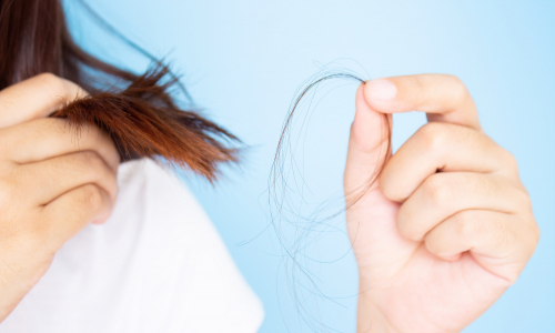 Vieš, ako poraziť vypadávanie vlasov? Pomôže ti tento tradičný a overený recept!
