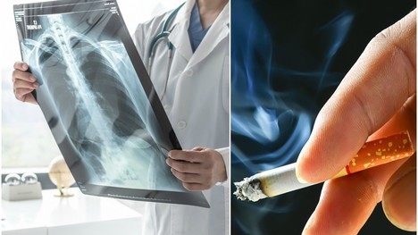 Čo je pľúcny emfyzém a ako sa prejavuje? Môže ho spôsobiť fajčenie?!