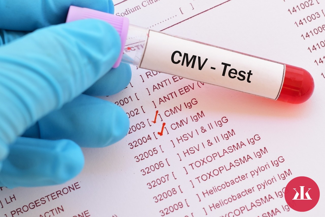 CMV infekcia