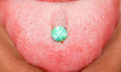 Riziká, ktoré skrýva piercing v jazyku