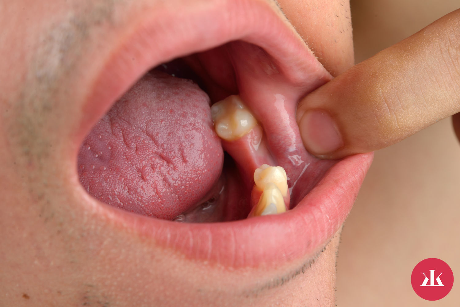 ako vitamin C vplyva na zuby