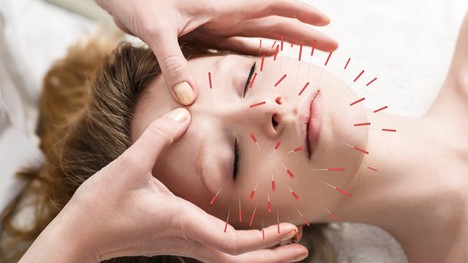 Tvárová akupunktúra alebo prírodný lifting tváre: Je účinná proti vráskam?