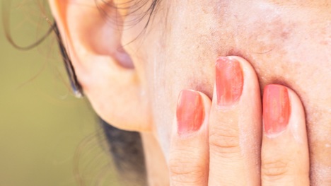 Beauty poradňa GERnétic: Čo s pigmentmi na tele a škvrnami na tvári?