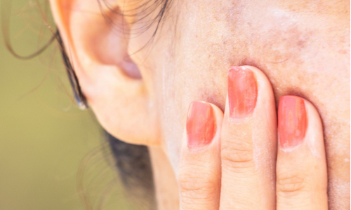 Beauty poradňa GERnétic: Čo s pigmentmi na tele a škvrnami na tvári?