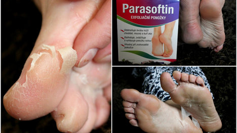TEST: Exfoliačné ponožky Parasoftin