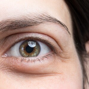 Čo oči odhalia o našom zdravotnom stave? Týchto 9 signálov neignoruj!