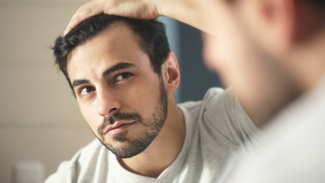 Toto sú hlavné príčiny vypadávania vlasov u mužov: Poznáš ich?