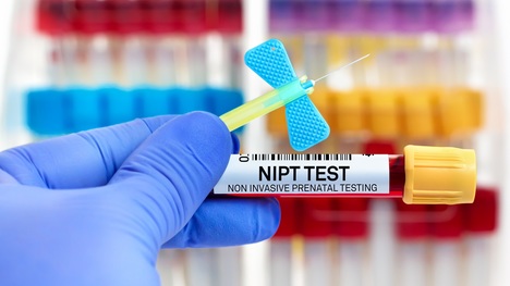 Genetické vyšetrenie v tehotenstve – čo je NIPT test, ako prebieha a aké vady plodu môže odhaliť?