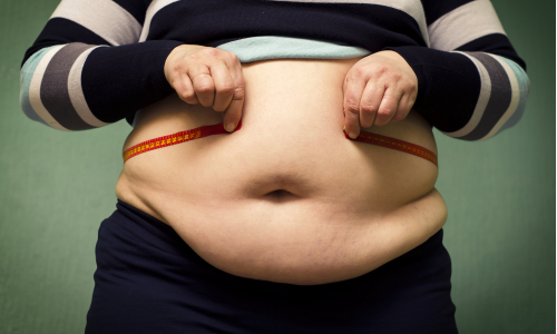 Najväčšie mýty o obezite: Môžu všetci obézni za svoju diagnózu?!