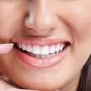 7 tipov na domáce bielenie zubov – ako na žiarivý chrup bez poškodenia?