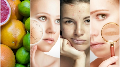 Starostlivosť o pleť pod lupou: Účinky kyselín v kozmetike