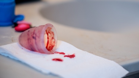 Čo ti prezradí farba menštruačnej krvi? Mala by si spozornieť!