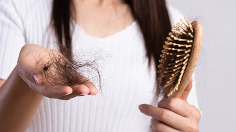 Hlavné príčiny vypadávania vlasov: Ako problém účinne riešiť?