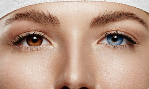 Ovplyvňuje farba očí naše zdravie? Budeš sa diviť!