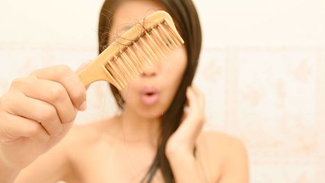 Vypadávanie vlasov - problém s jedným riešením, ktorým je Parusan