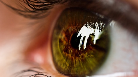 Signály očí vám prezradia desivé informácie o vašom zdraví