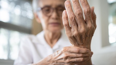 Reumatoidná artritída: V ktorom veku sa začína prejavovať a ako?