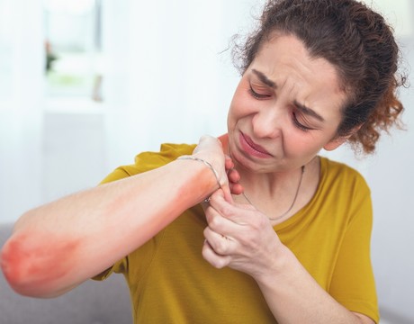 Ako sa prejavuje alergia na kov? Možno ňou trpíš aj ty!