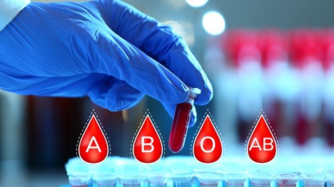 Možnosti transfúzie krvi: Vieš, kto komu môže darovať krv?