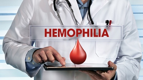 Hemofília - kto je ohrozený najviac? Čo by sme o nej mali vedieť?
