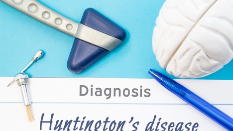 Huntingtonova choroba – vzácna, zákerná a dedičná! Čo je jej príčinou?