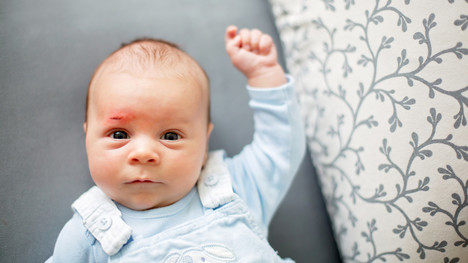 Aké sú najčastejšie úrazy bábätiek? Rodičia, takto im zamedzíte!
