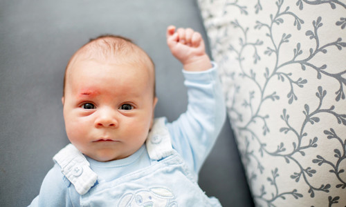 Aké sú najčastejšie úrazy bábätiek? Rodičia, takto im zamedzíte!