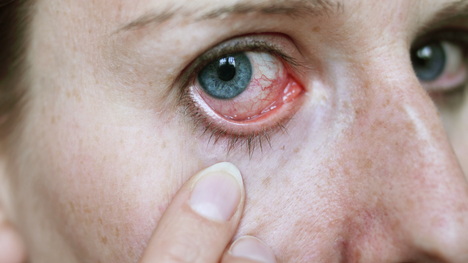 Ako rozoznať alergiu od zápalu? Tu je niekoľko tipov od odborníkov