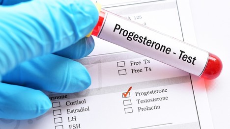 Progesterón – čo všetko je potrebné vedieť o tomto ženskom hormóne?