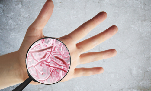 Nový vedecký objav: Vieš, čo znamená pojem kožná mikroflóra?