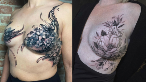 Mastektómia a tetovanie: Umelecké dielo namiesto jazvy